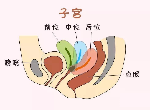 子宫后位怀孕更简单？受孕成功率与子宫的位置没有太大关联