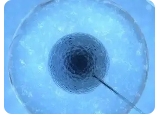 试管婴儿超长方案促排的具体步骤是什么？